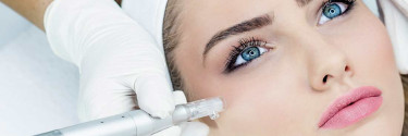 Découvrez le microneedling en institut !