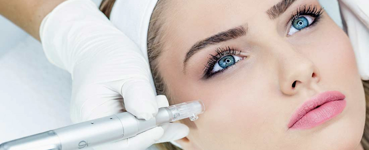 Découvrez le microneedling en institut !