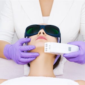 MENTON- EPILATION LASER
