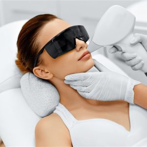 JOUES -  EPILATION LASER