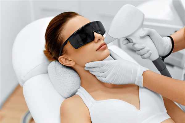 JOUES -  EPILATION LASER