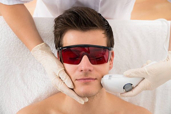 EPILATION LASER-POMMETTE ET TEMPES-