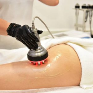 Traitement par cavitation et radiofrequence