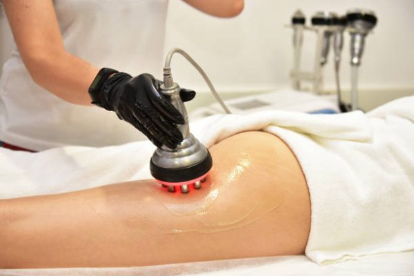 Traitement par cavitation et radiofrequence