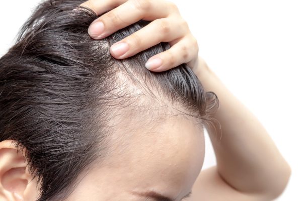 RECONSTRUCTION DES CHEVEUX - FORFAIT 5 SÉANCES & 1 SERUM POST TRAITEMENT