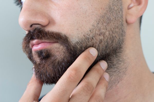 RECONSTRUCTION DE LA BARBE - FORFAIT 4 SÉANCES & 1 SERUM POST TRAITEMENT